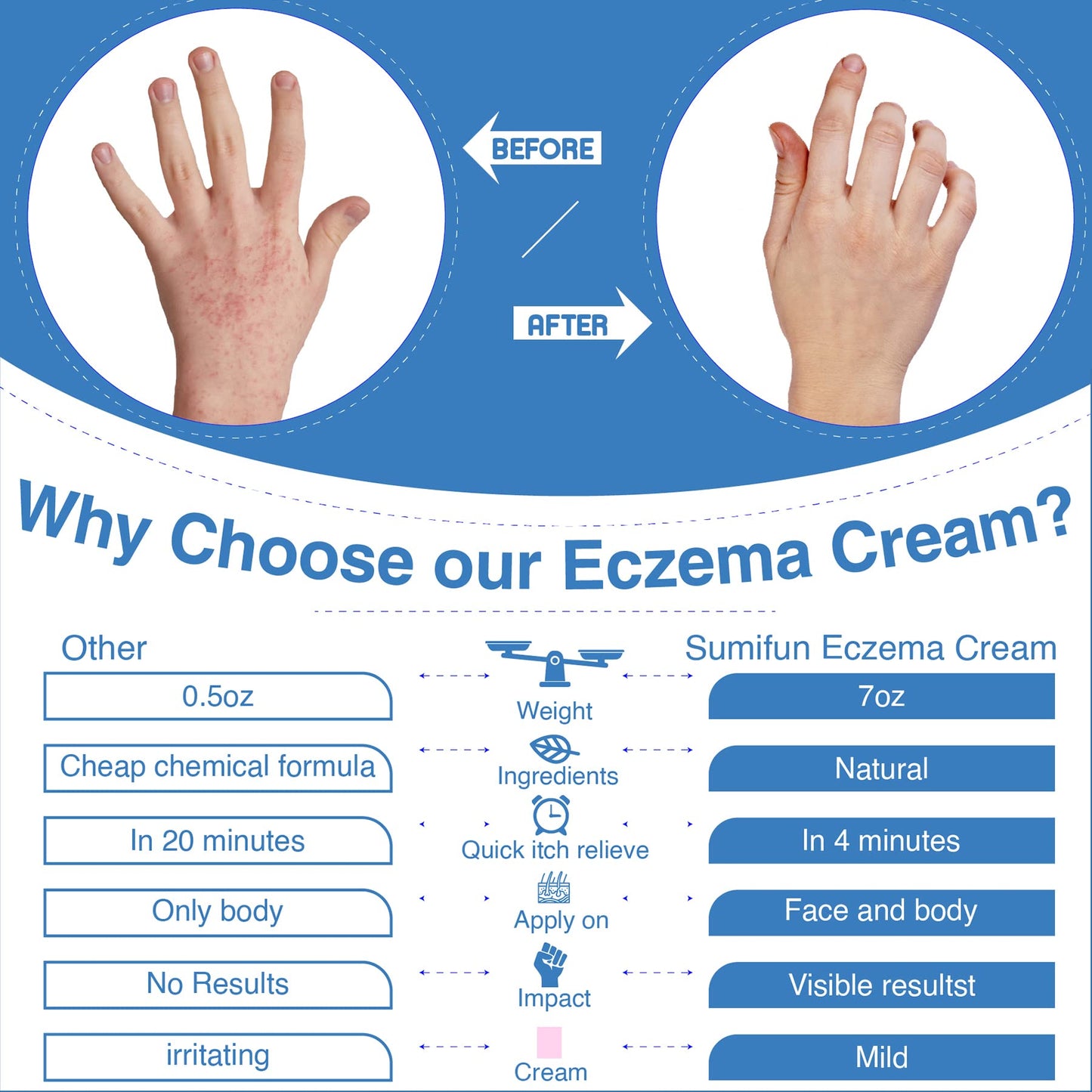 Sumifun Eczema Relief Cream
