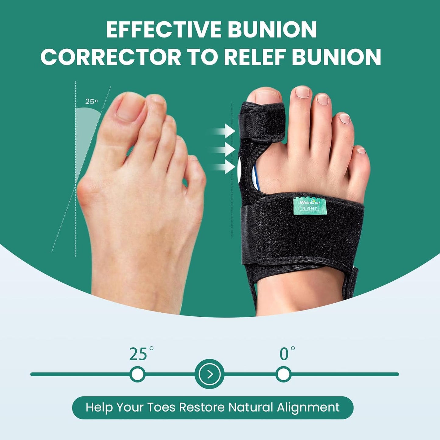 Welnove Bunion Corrector