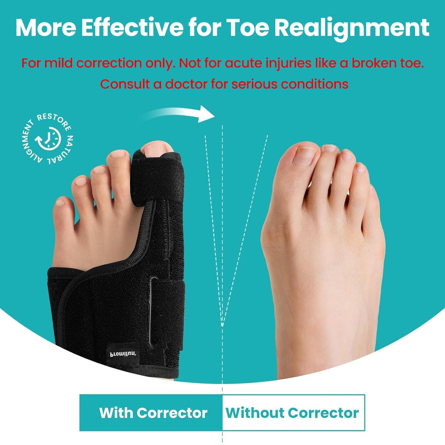 Promifun Bunion Relie & Toe Corrector