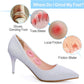 Welnove 135Pcs Oval Corn Cushion Pads