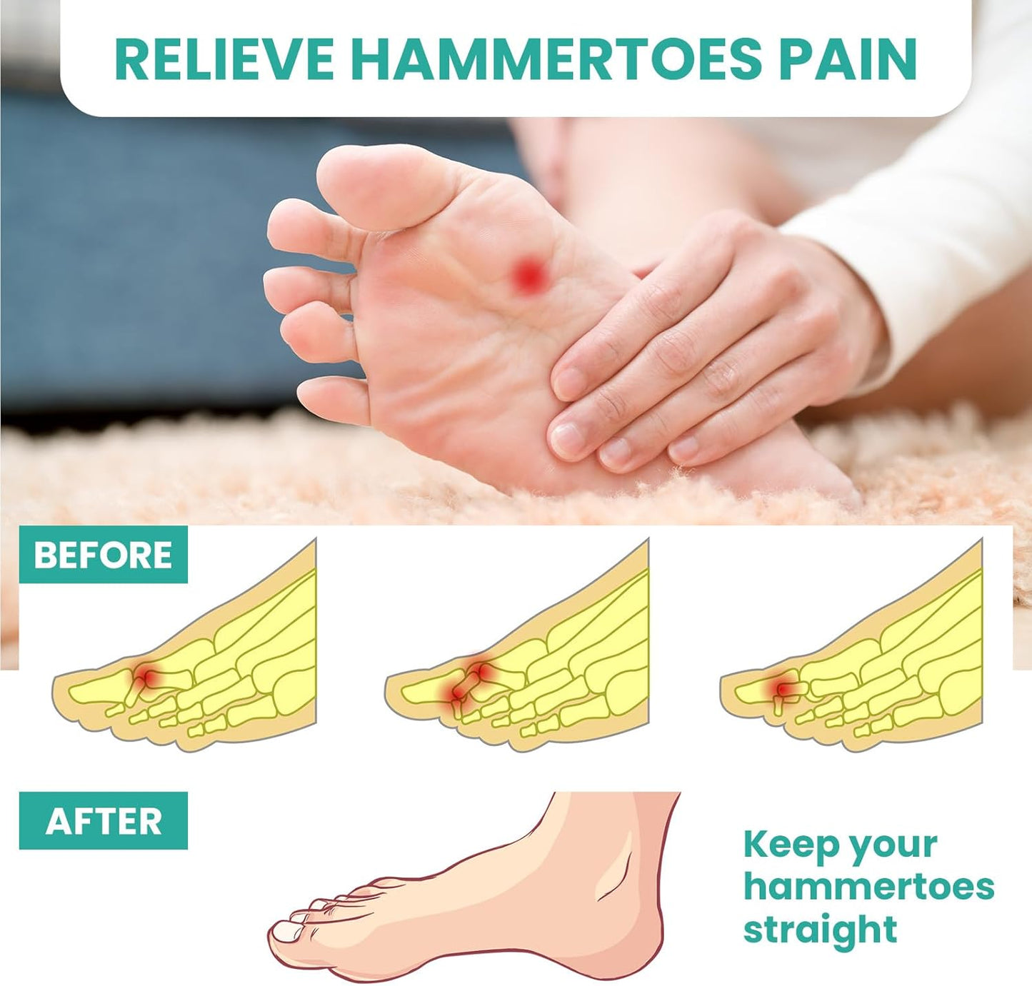 Welnove Hammer Toe Straightener, Clear, 3 Loop