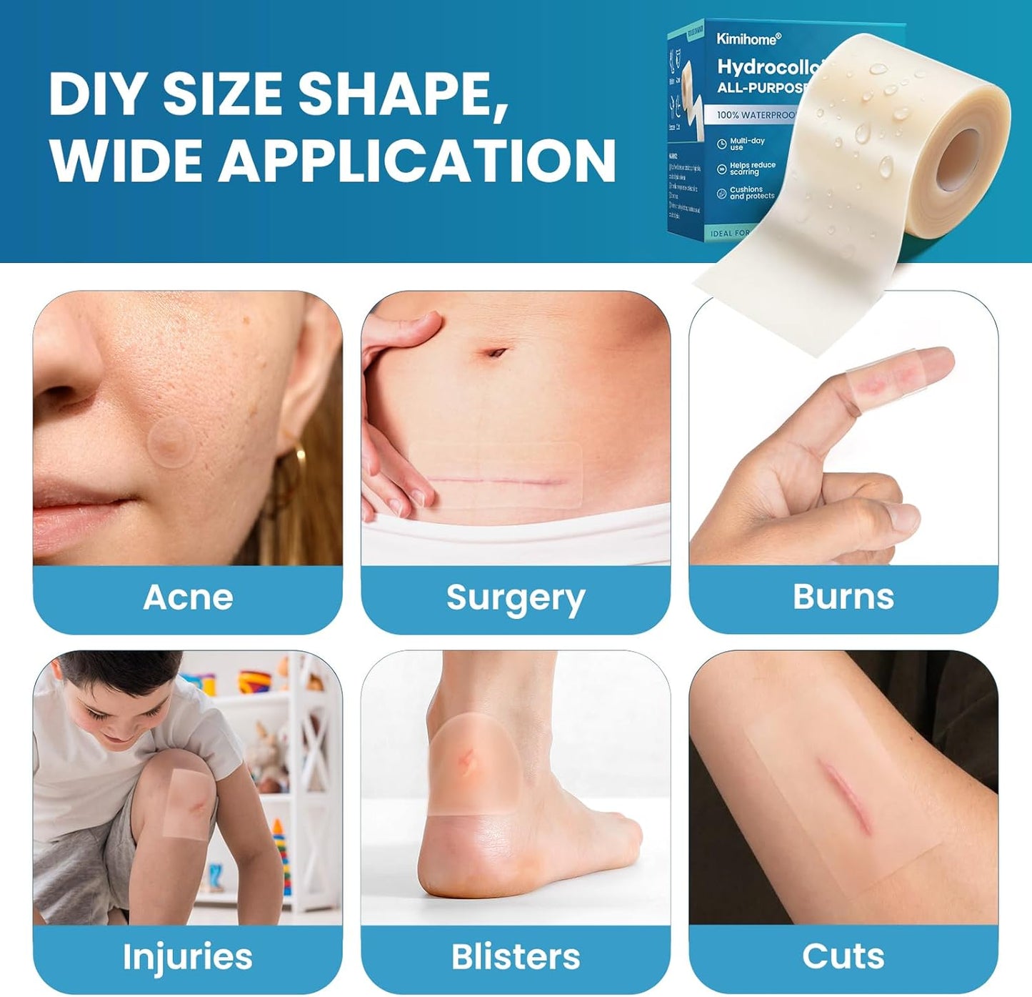 Kimihome Hydrocolloid Roll All-Purpose