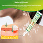 Sumifun 6 Counts Vitiligo Cream