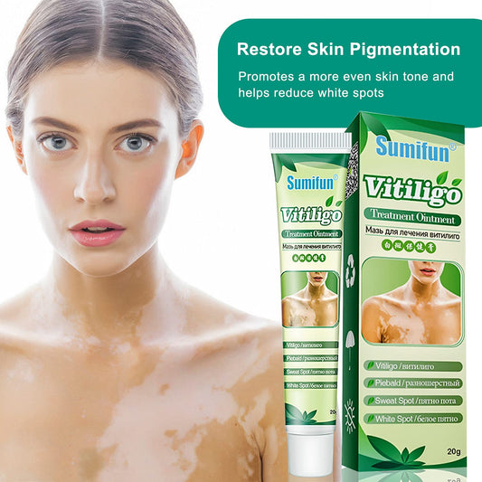 Sumifun 6 Counts Vitiligo Cream